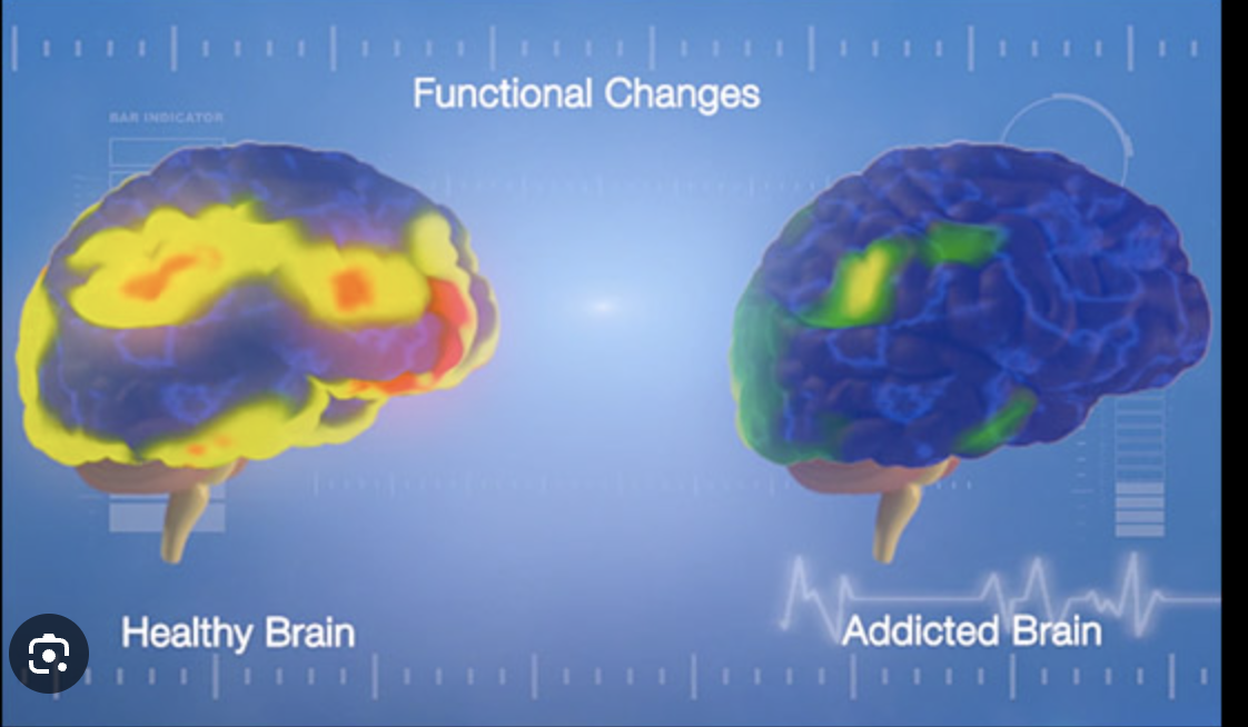 How an Addicted Brain Works