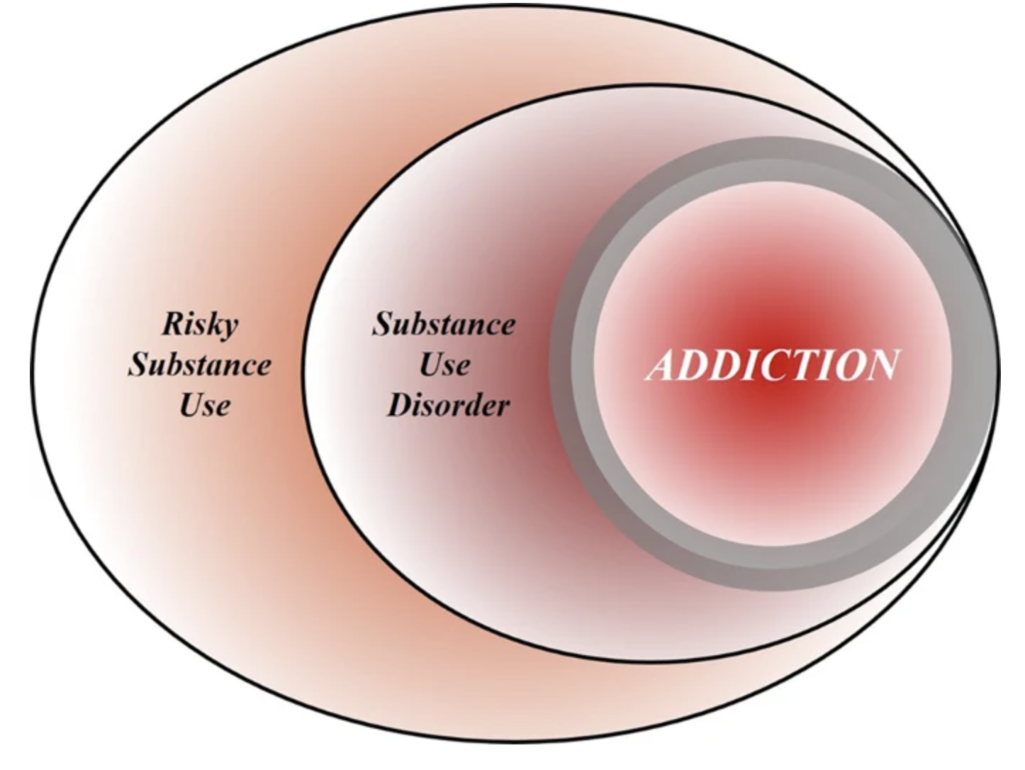 Addiction as a brain disease revised: why it still matters, and the need for consilience